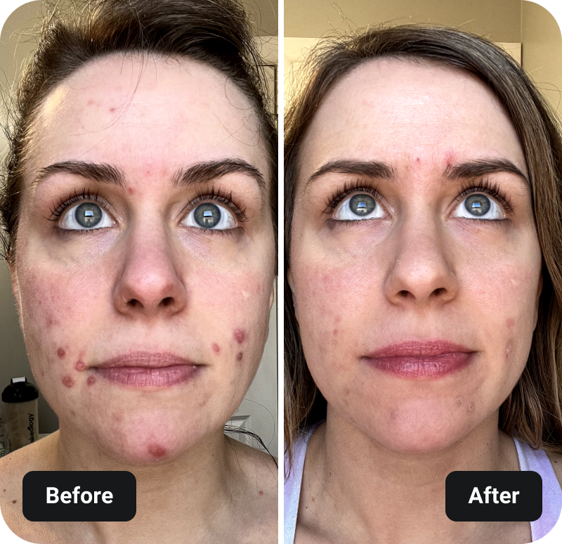 4 Week Gut Protocol before and after results